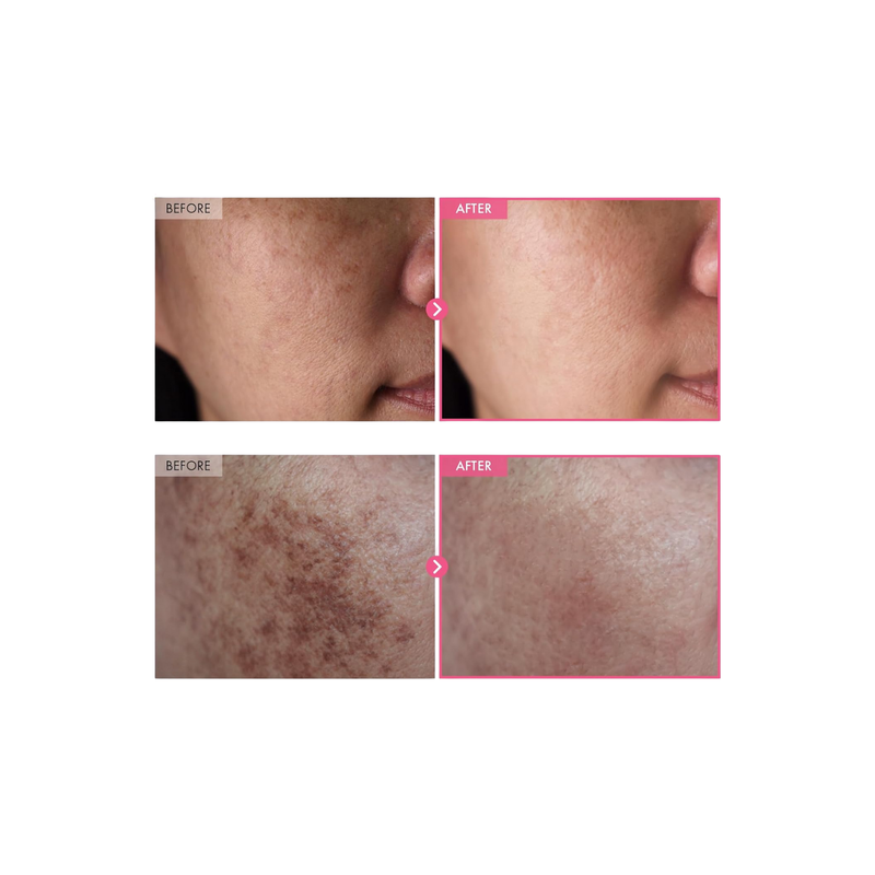 4. Fades Dark Spots & Old Scars